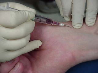 Arteriyel Kan Gazı Özellikleri ve Faydaları Nelerdir?